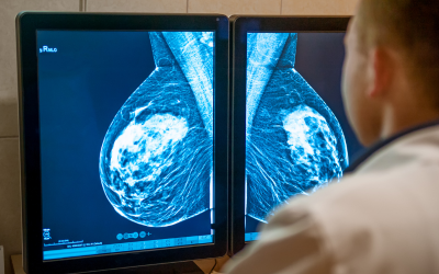mammogram