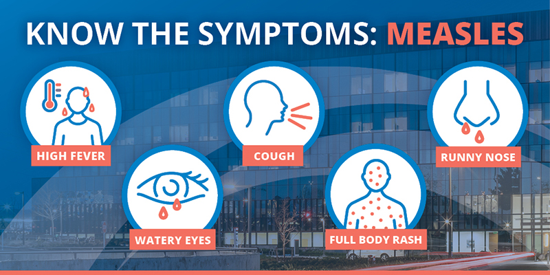 Measles symptoms graphic