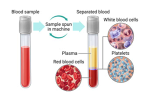 PRP illustration of blood separation process.