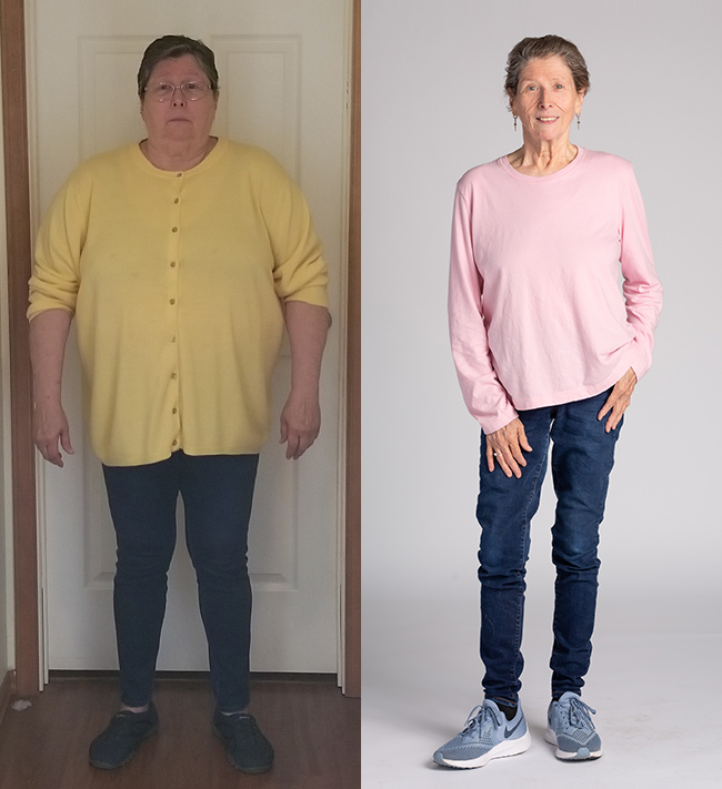 Nancy Before & After Weight Loss Journey Side by Side 