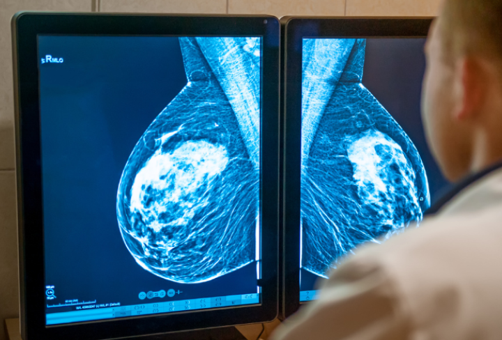 mammogram