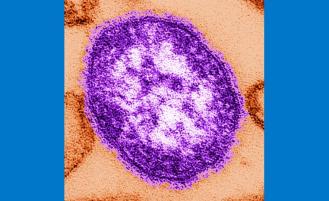 Measles Virus Stock Image CDC