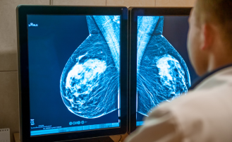 mammogram